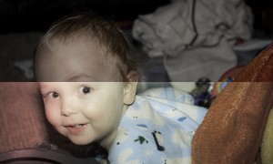 Before and After